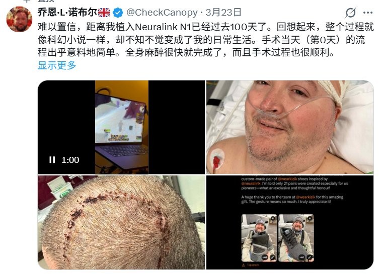 英国退伍军人植入Neuralink芯片，用脑机接口畅玩《魔兽世界》-咸鱼单机官网